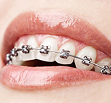 srvc-ortho